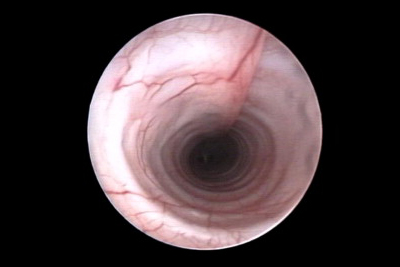 endoscopy_small